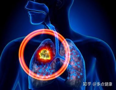 azd9291奥希替尼_奥希替尼印度版白盒_奥希替尼联合甘露醇