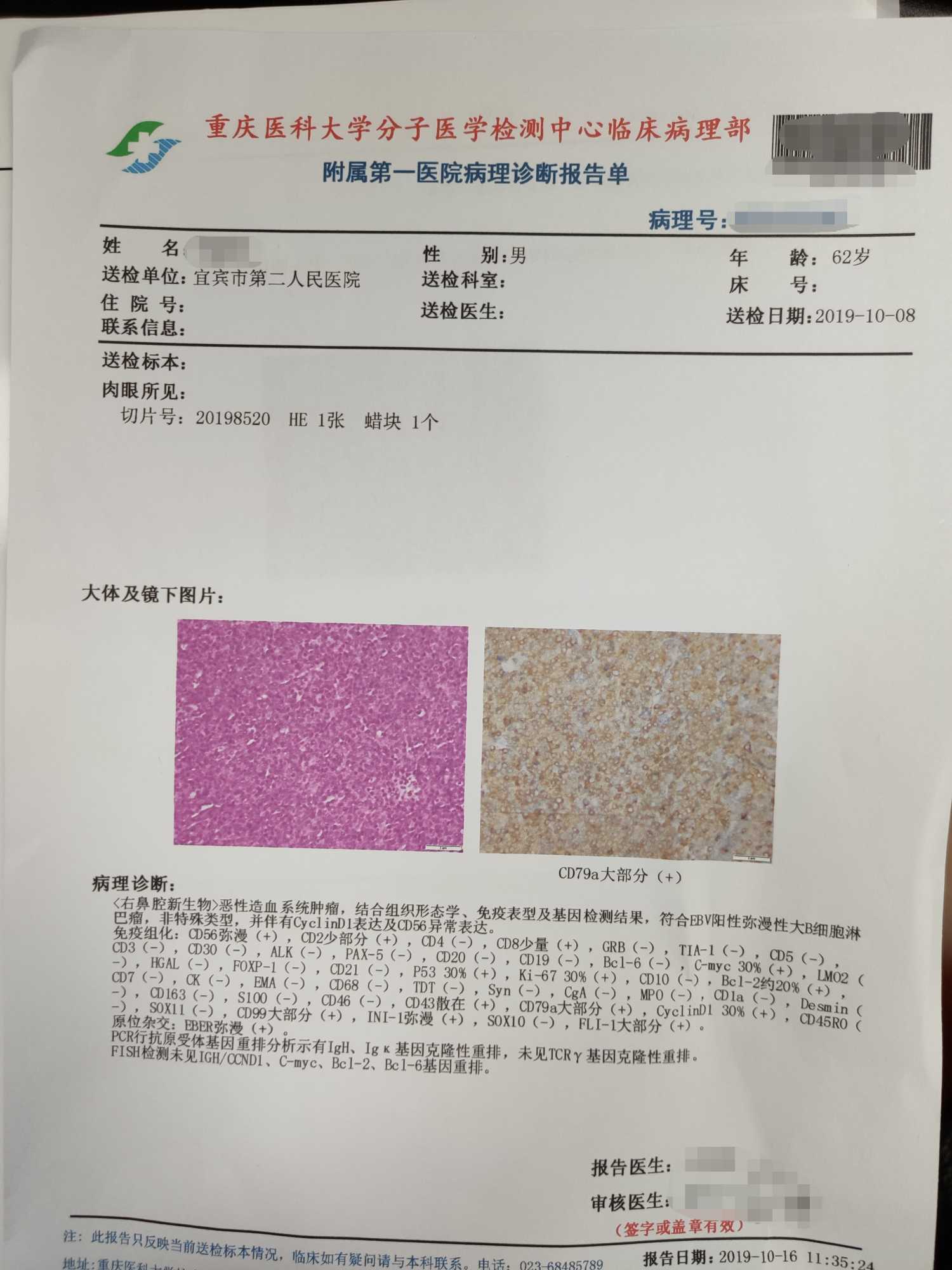 本妥昔单抗_贝伐单抗停多久用西妥昔单抗_西妥昔珠单抗说明书