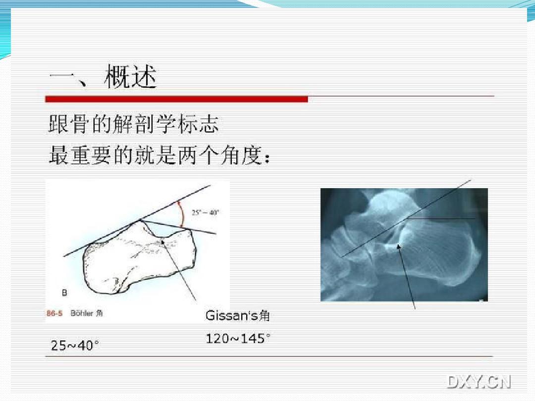 贝伐珠单抗靶向是啥_替吉奥胶囊贝伐珠单抗_贝伐珠单抗治疗肺腺癌