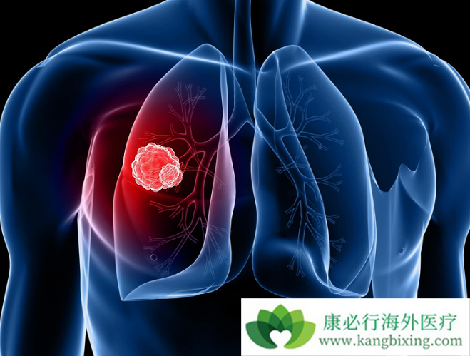 贝伐单抗赠药条件_贝伐单抗用多久会耐药_贝伐单抗靶向药会脱发吗