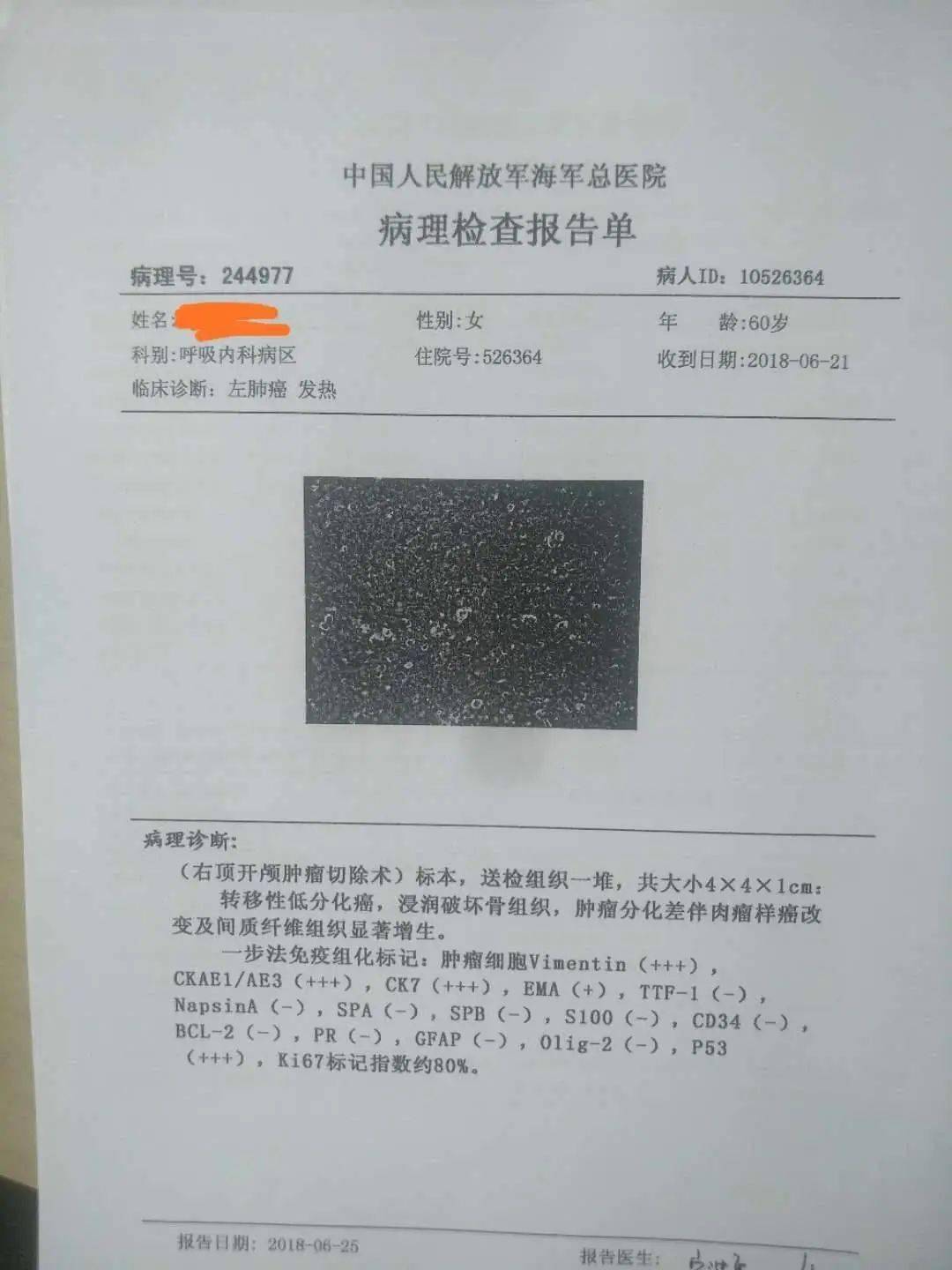 吉非替尼敏感患者l858r_患者服用阿帕替尼评价_尼毕鲁杨祥吉的妻子