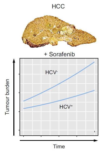 索拉非尼肝癌延长时间_索拉非尼适合肝癌吗_索拉非尼 肝癌