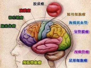 贝伐单抗耐药性_贝伐单抗可以治疗脑水肿吗_贝伐单抗是靶向药吗