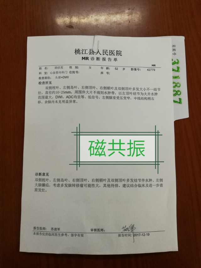 贝伐单抗新消息_贝伐珠单抗价格_贝伐珠单抗是化疗药吗