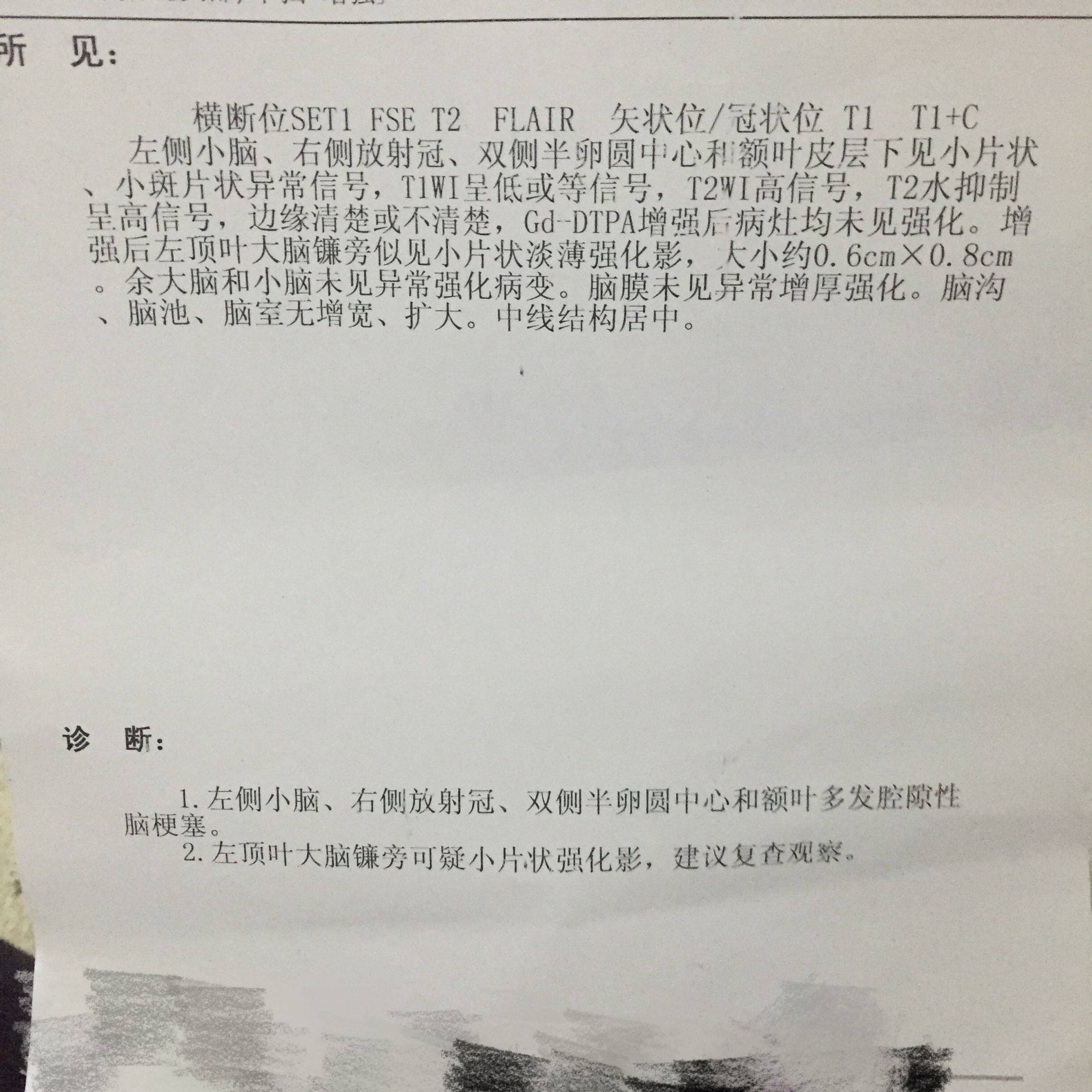 癌细胞转移脑部的症状_吉非替尼对脑转移_多美吉 索拉非尼