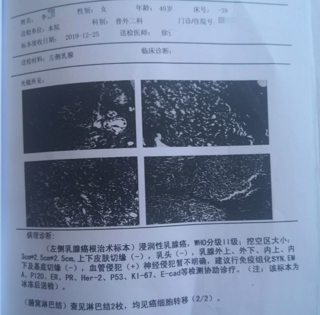 贝伐单抗乳腺癌新辅助_贝伐珠单抗是化疗药吗_贝伐单抗对脑转移癌有效