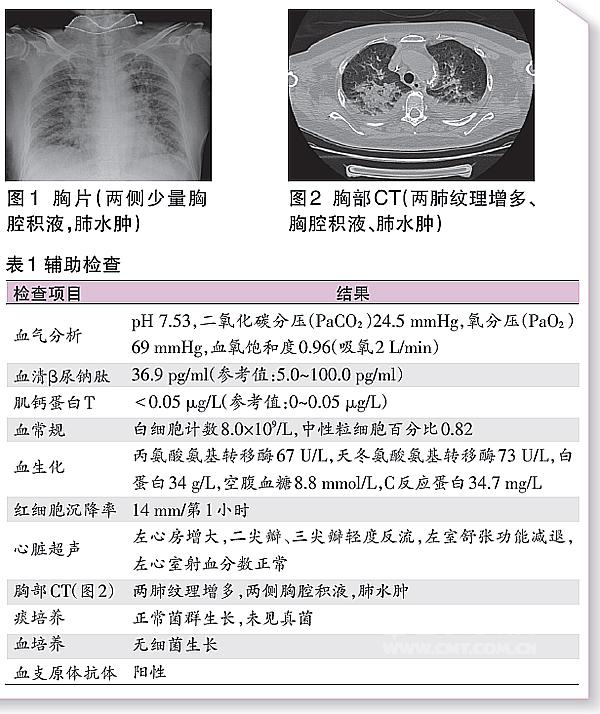 贝伐珠单抗_贝伐珠单抗胸腔积液肠癌_贝伐珠单抗最新价格