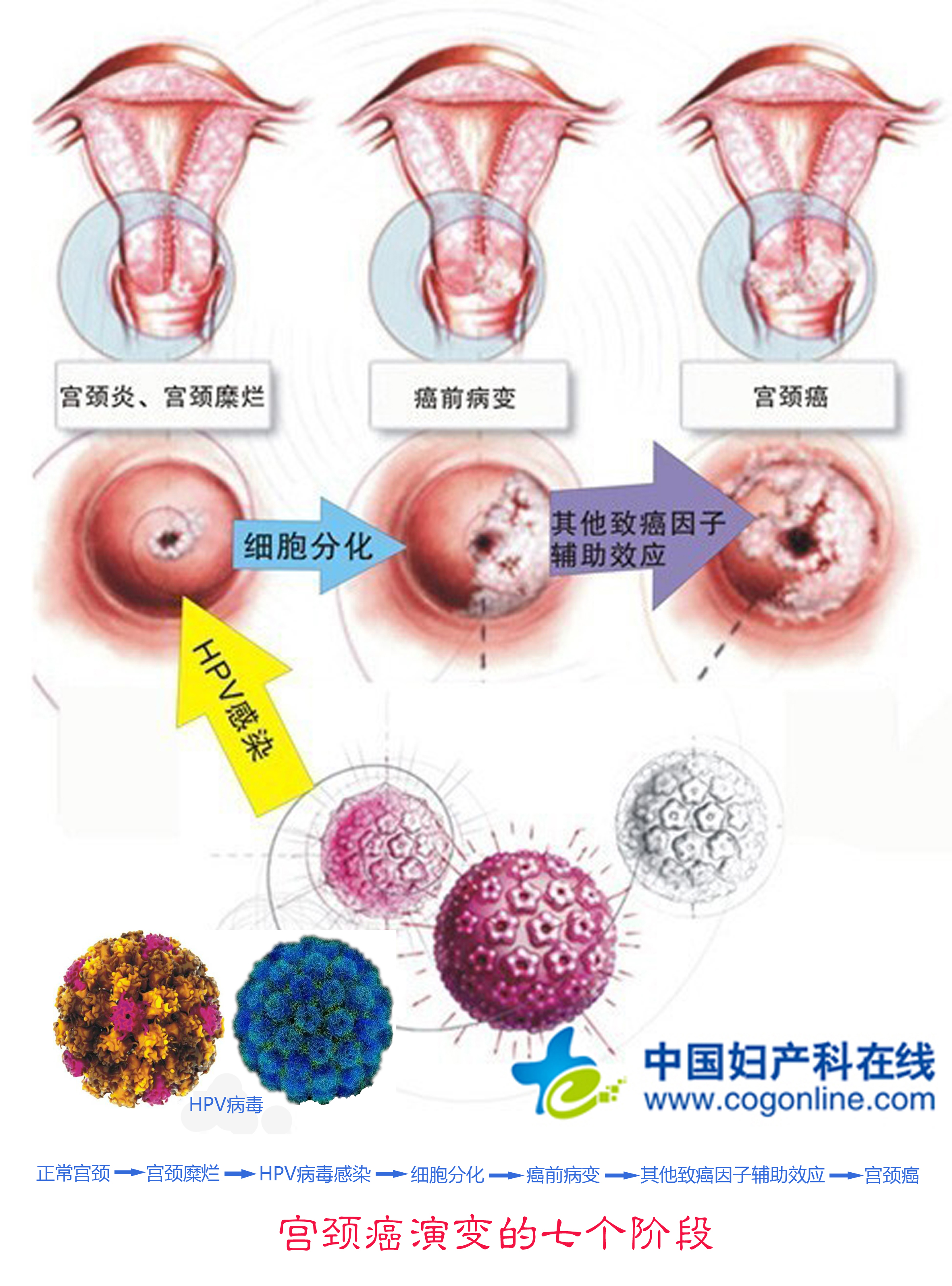 贝伐珠单抗可以报销吗_宫颈癌使用贝伐单抗例子_贝伐单抗多久有耐药性