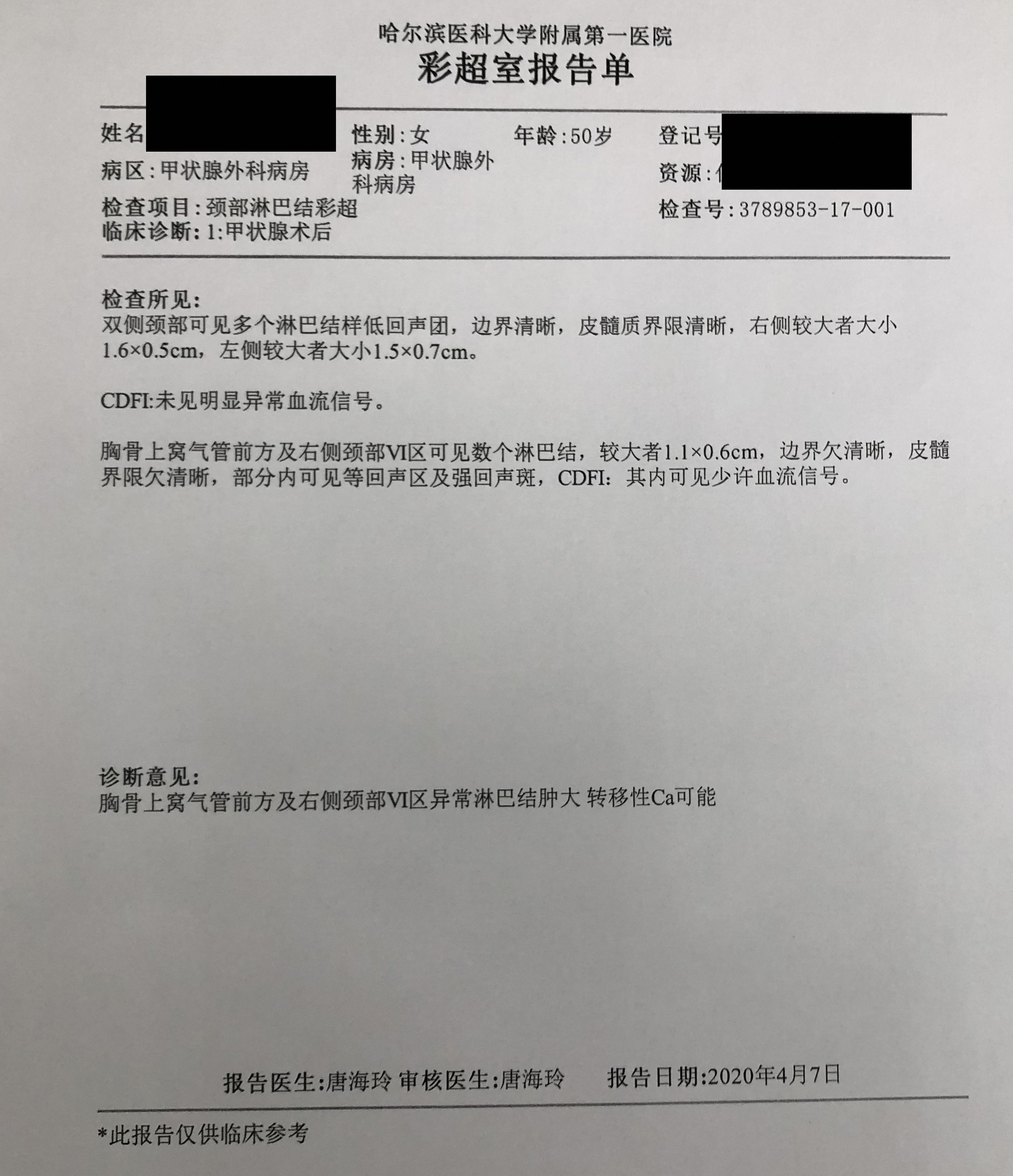 门静脉癌栓 索拉非尼_索拉非尼对甲状腺癌的效果_索拉非尼 效果