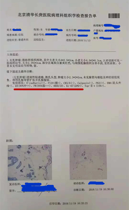 贝伐珠单抗治疗三阴乳腺癌效果_贝伐珠单抗注射液_贝伐珠单抗多少钱一支