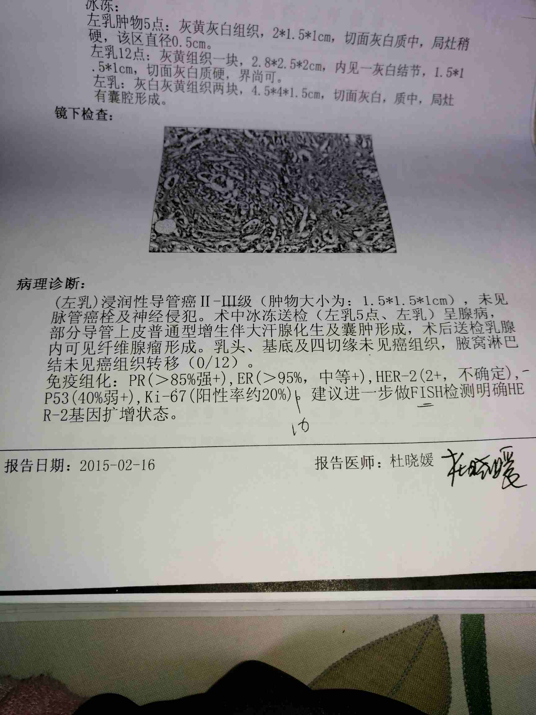 贝伐珠单抗多少钱一支_贝伐珠单抗治疗三阴乳腺癌效果_贝伐珠单抗注射液