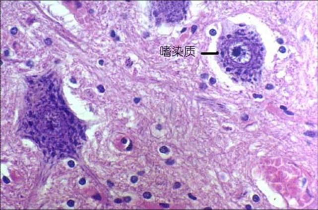 黄芪成分异鼠与索拉非尼联合使用后对肾癌的生长抑制作用及其作用机制