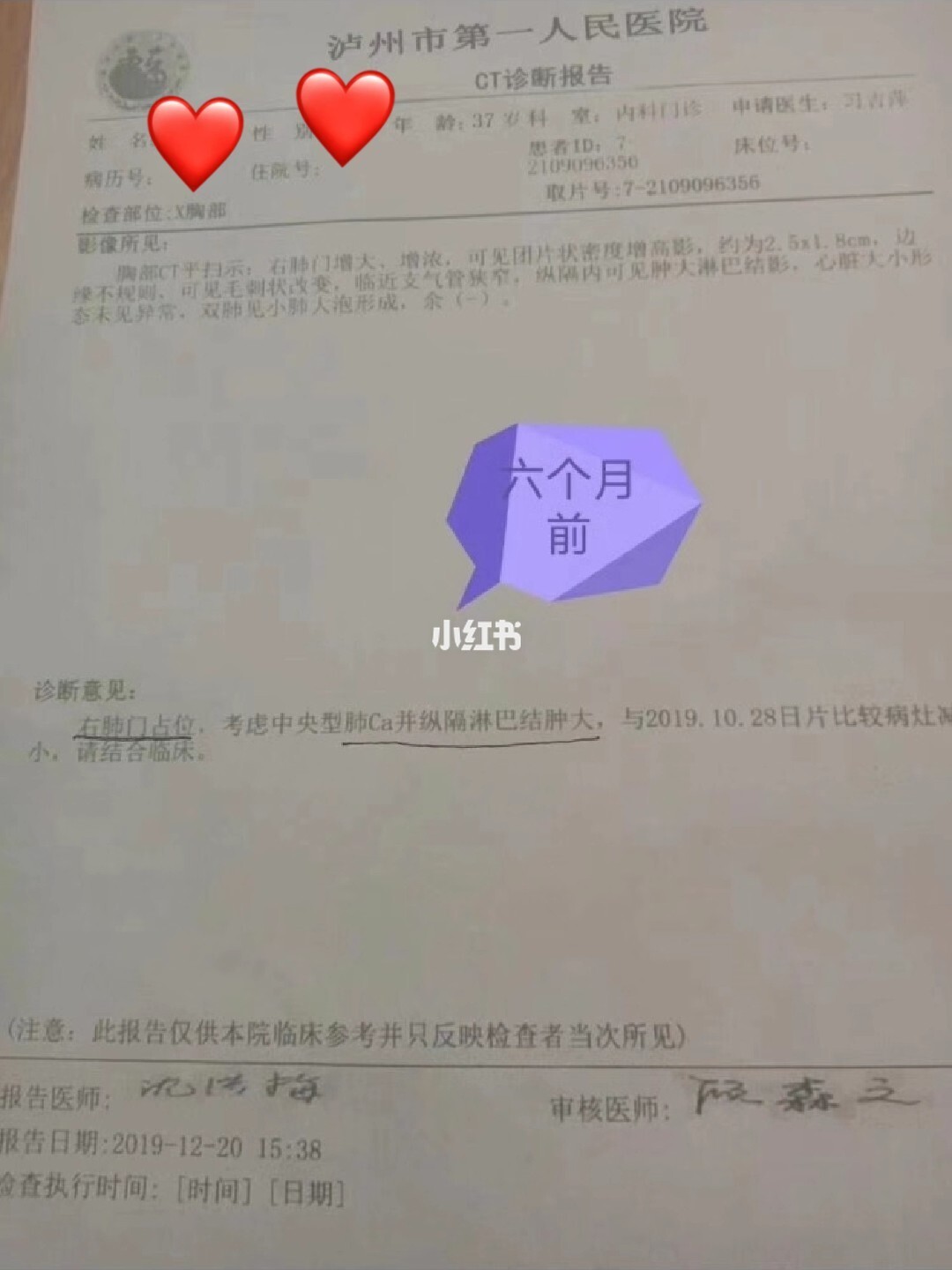 azd9291奥希替尼_奥希替尼后四代靶向药_肺癌吃靶向药后没胃口吃饭