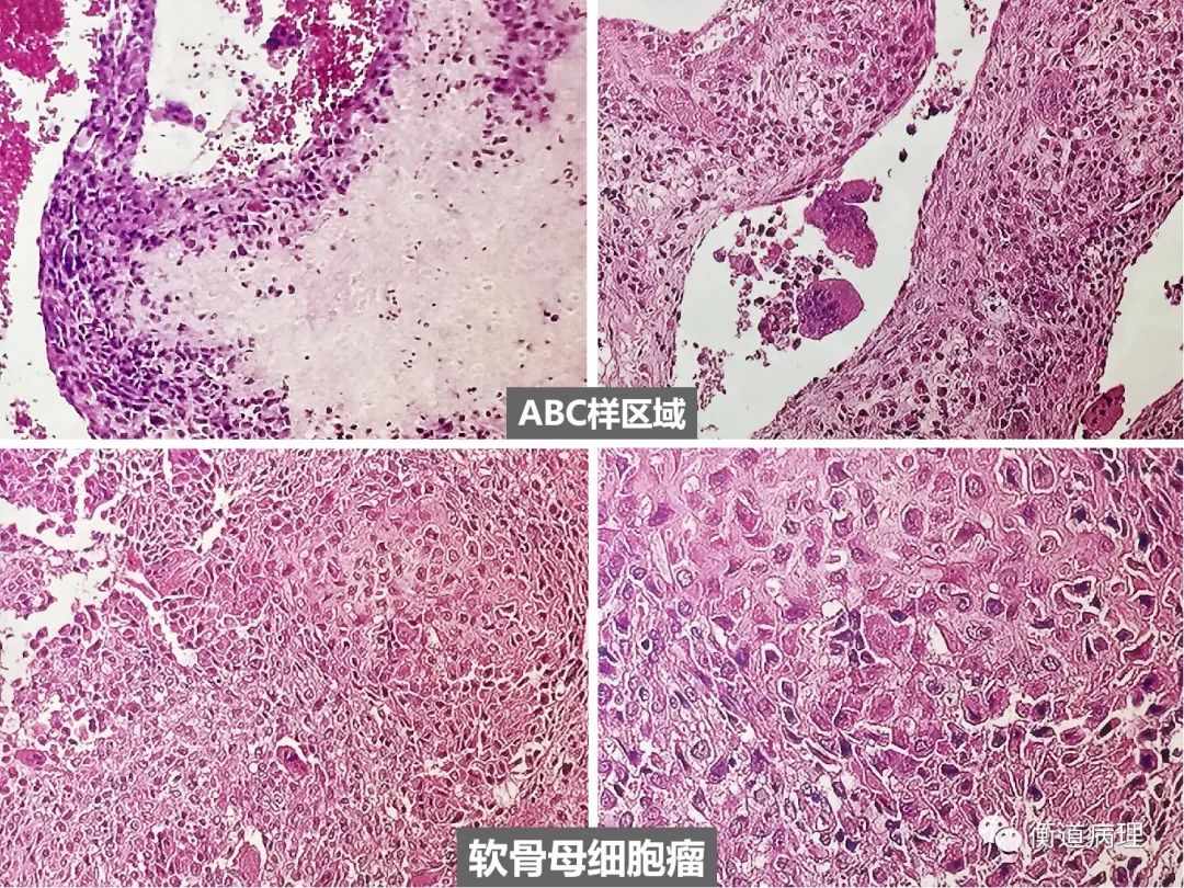 靶向药物治疗真的那么神奇吗？这次医生终于说清楚了
