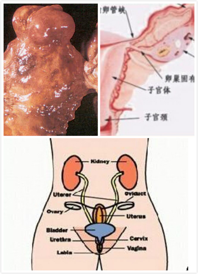 贝伐珠单抗是化疗药吗_贝伐珠单抗不良反应_贝伐单抗是parp抑制剂吗