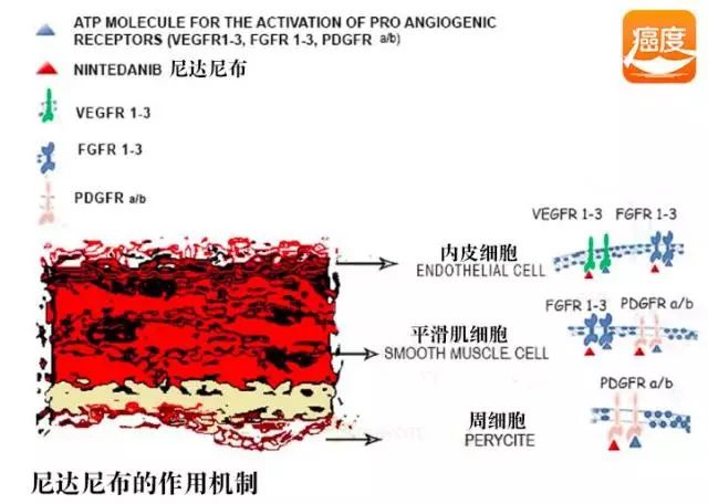 A+T(抗血管+靶向)模式是什么？
