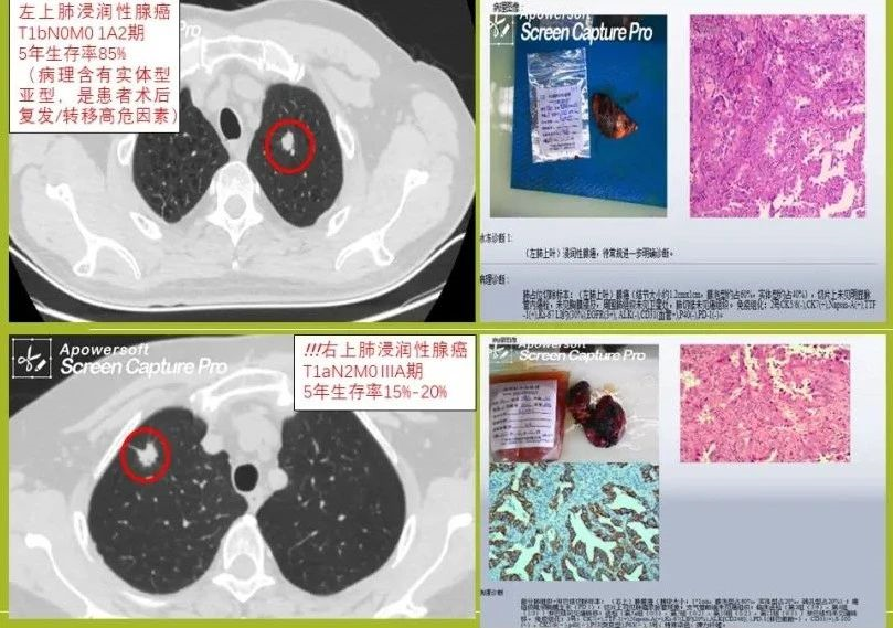 多种创新药物被纳入医保目录，越来越、医有所保
