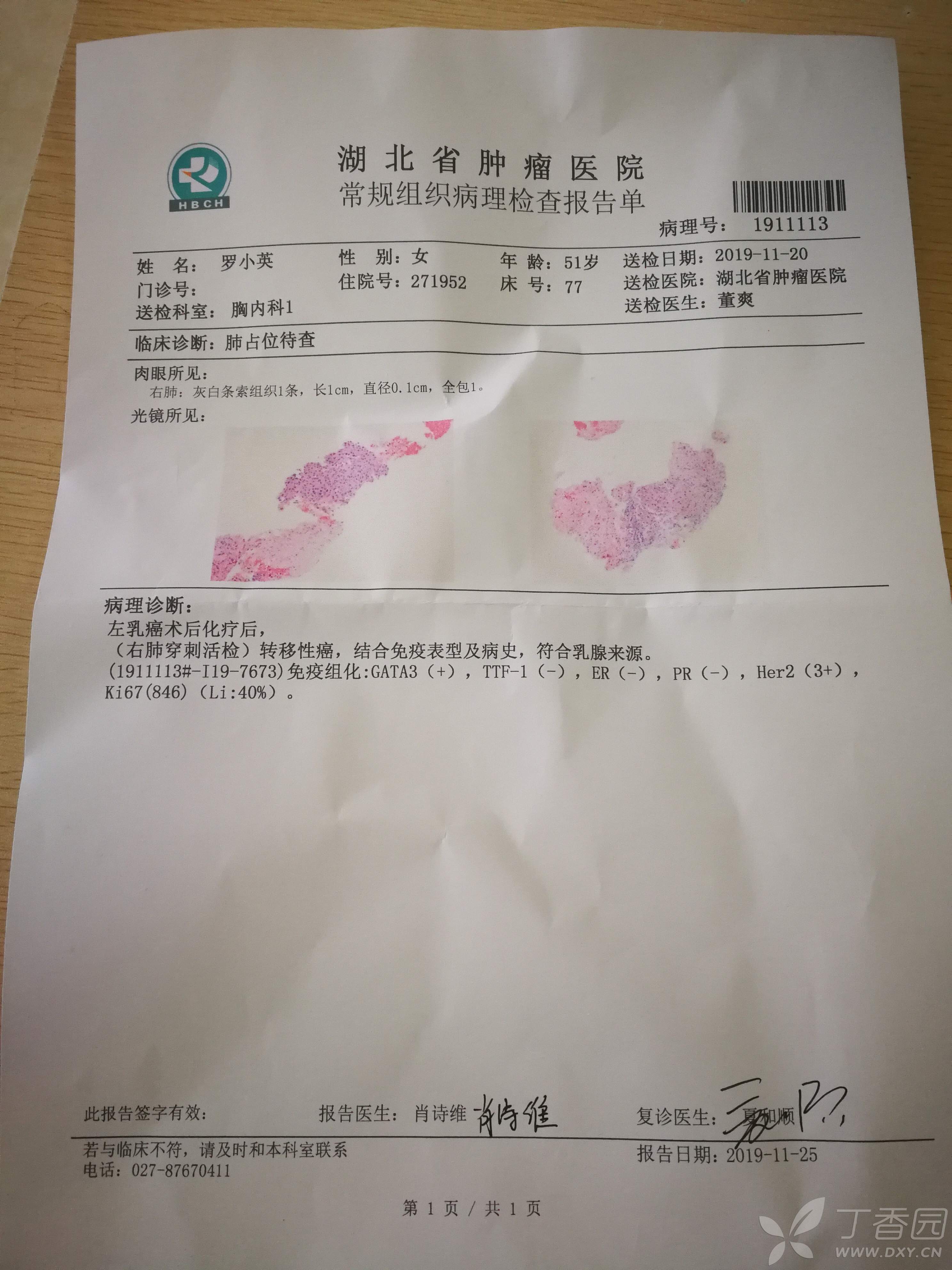 中期鼻咽癌能治愈吗_吉非替尼鼻咽癌能用吗_鼻咽癌医生建议打尼妥珠单抗
