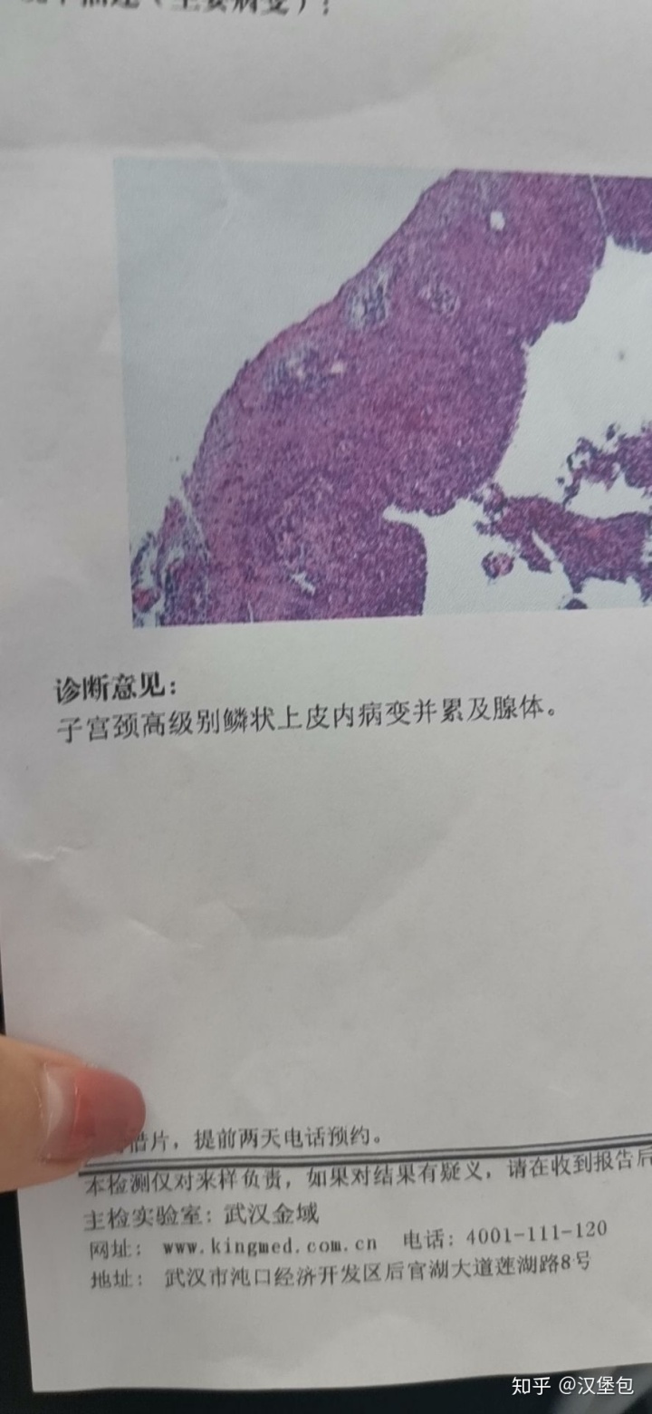 索拉非尼是哪一类抗肿瘤药物_索拉非尼要做基因检测么_索拉非尼