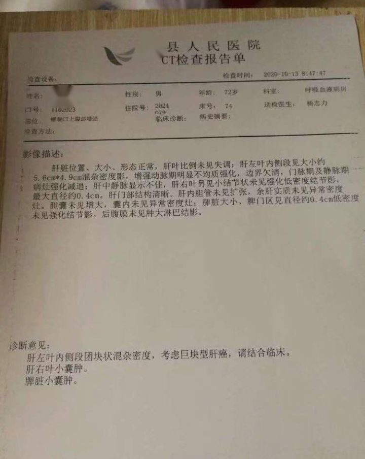 贝伐珠单抗_贝伐珠单抗脑癌有效吗_贝伐珠单抗4个月后赠药