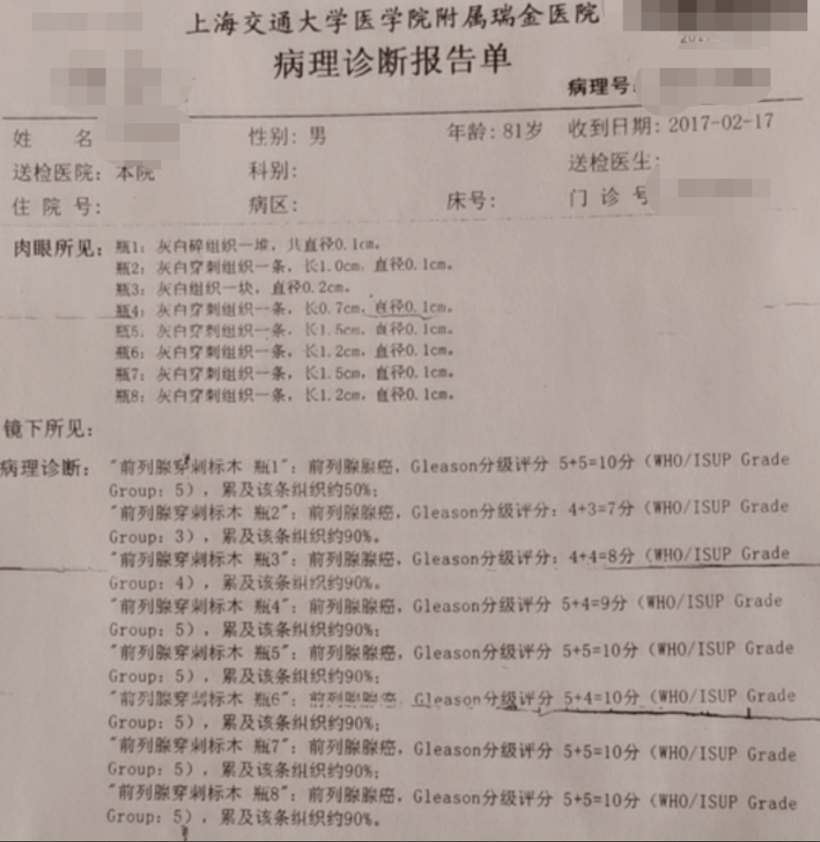 肾癌 靶向药物舒尼替尼_索拉非尼要做基因检测么_肾癌索拉非尼效果明显