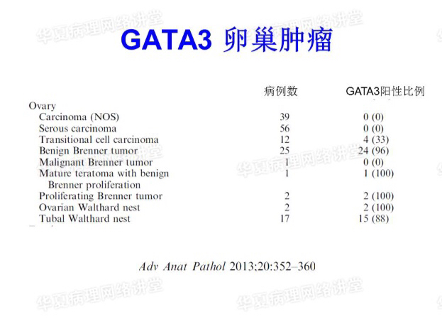 贝伐珠单抗辅助治疗高剂量α-2b干扰素