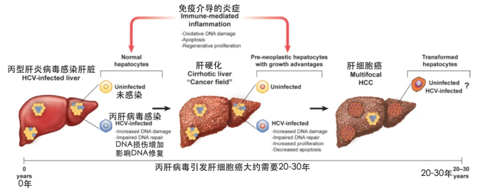 索拉非尼价格_索拉非尼片_索拉非尼腹泻的治疗