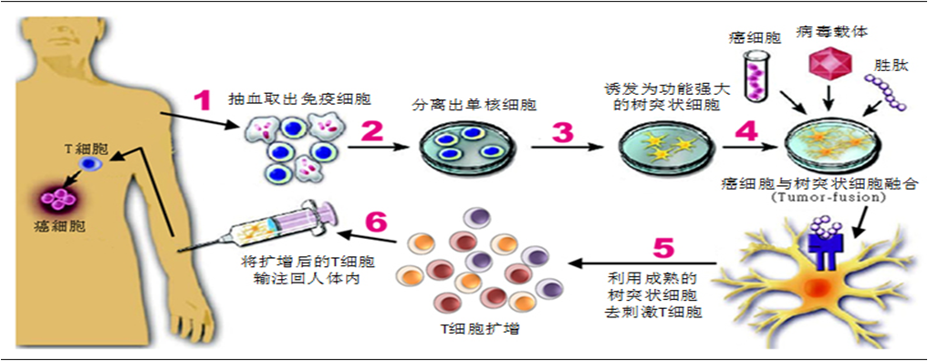 肺癌中期化疗能活多久_肺癌中期是吉非替尼能活多久_肺癌中期手术后能活多久