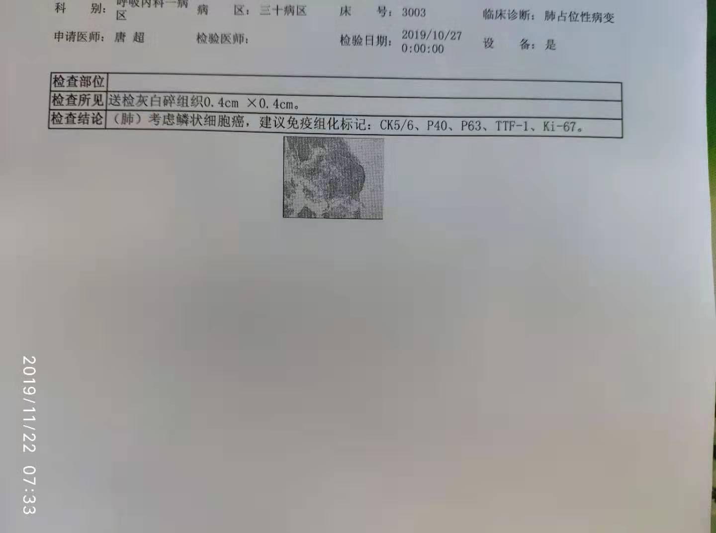 肠镜是癌而活检是癌怎么办_吉非替尼片是抗各种癌吗_抗宫炎片是消炎药吗