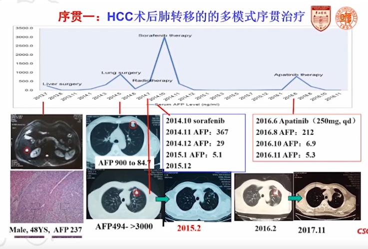 胸腺癌早期能活多久_吉非替尼胸腺癌_胸腺癌属于肺癌么