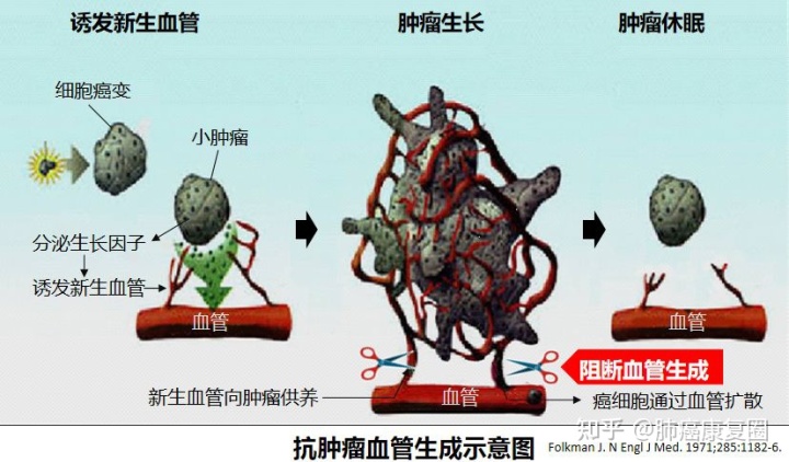 结肠癌晚期用贝伐单抗治好_肺癌新药贝伐单抗_贝伐珠单抗