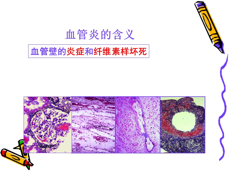 ILD尼没有禁忌症名接受奥希替尼治疗的患者3.7