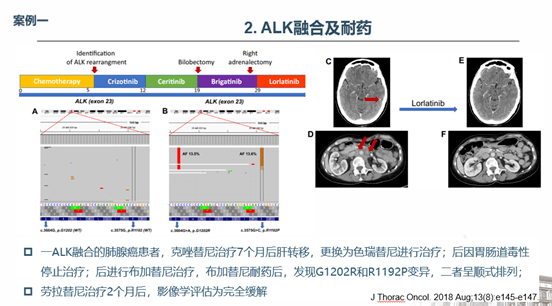 服用吉三代后体重减轻_克唑替尼耐药后alk阳性_服用吉非替尼耐药后表现