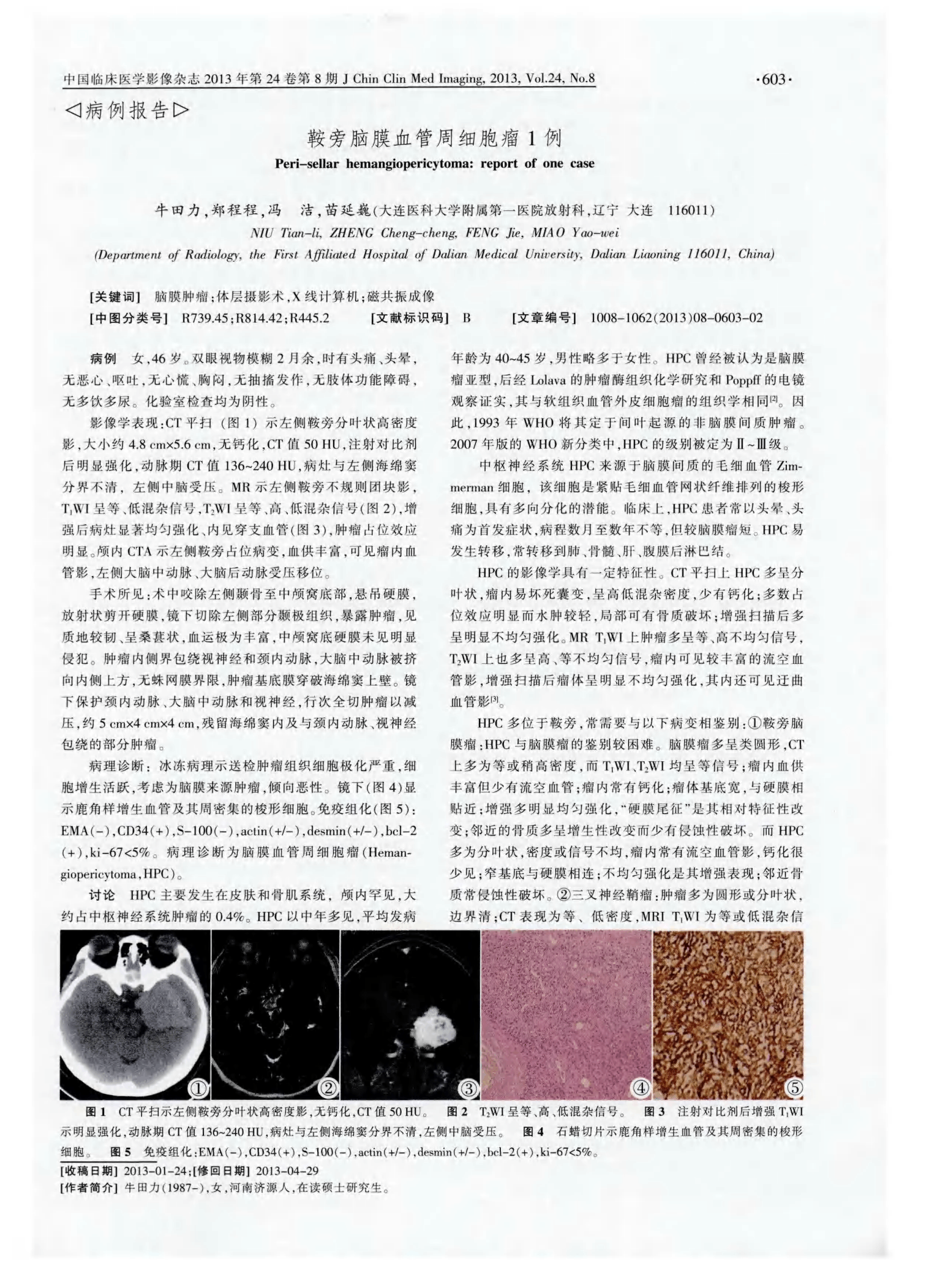 中国国家药品监督管理局单抗在中国上市申请获NMPA受理的生物类似药产品