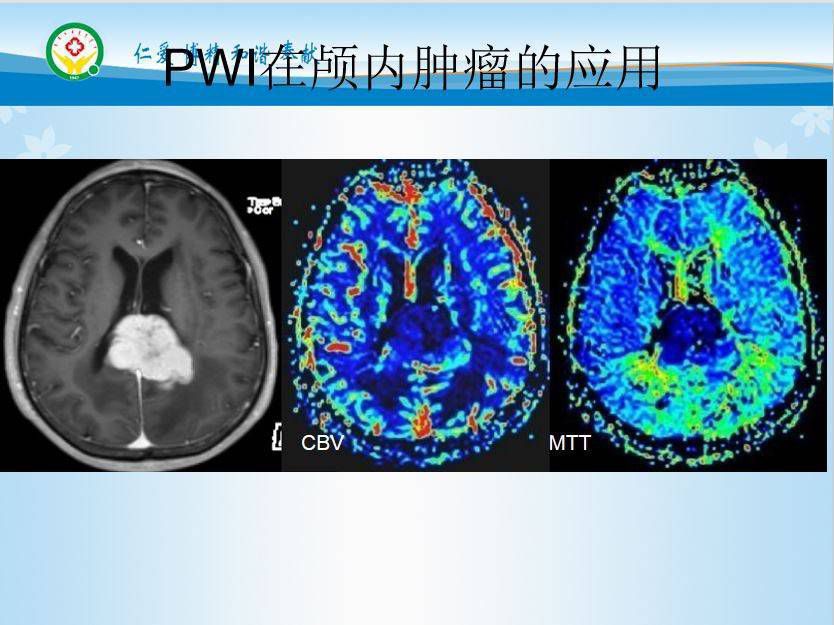 贝伐单抗和贝伐珠单抗_贝伐珠单抗是化疗药吗_贝伐单抗能不能透过血脑屏障