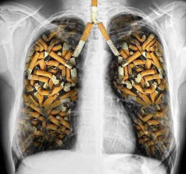 奥希替尼印度版多少钱_奥希替尼印度版白盒_服用奥希替尼体重减少