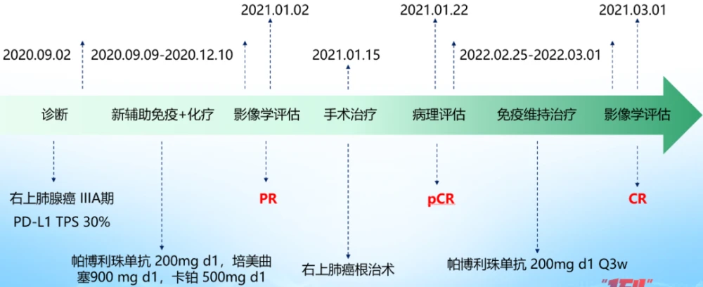 紫杉醇和卡铂联合用于转移性非鳞状非小细胞肺癌患者的一线治疗