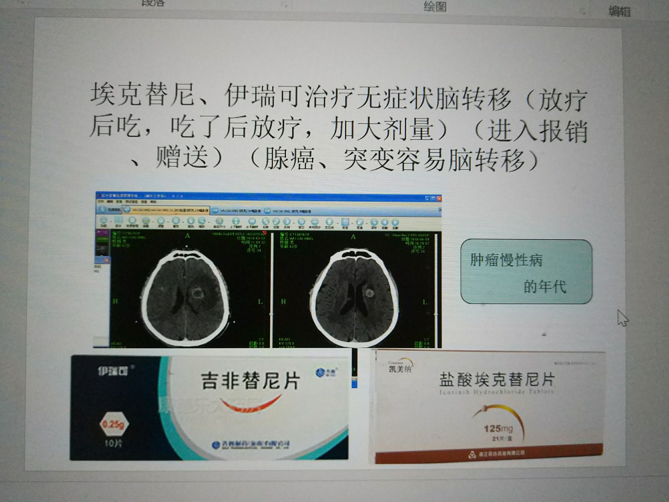 印度版奥希替尼_奥希替尼印度版多少钱_奥希替尼能治疗脑转移吗