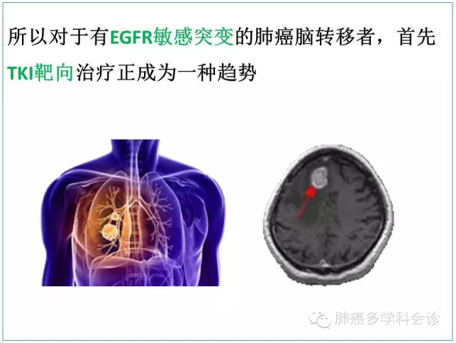EGFR突变初始治疗如何获益最大化？——肺腾大会