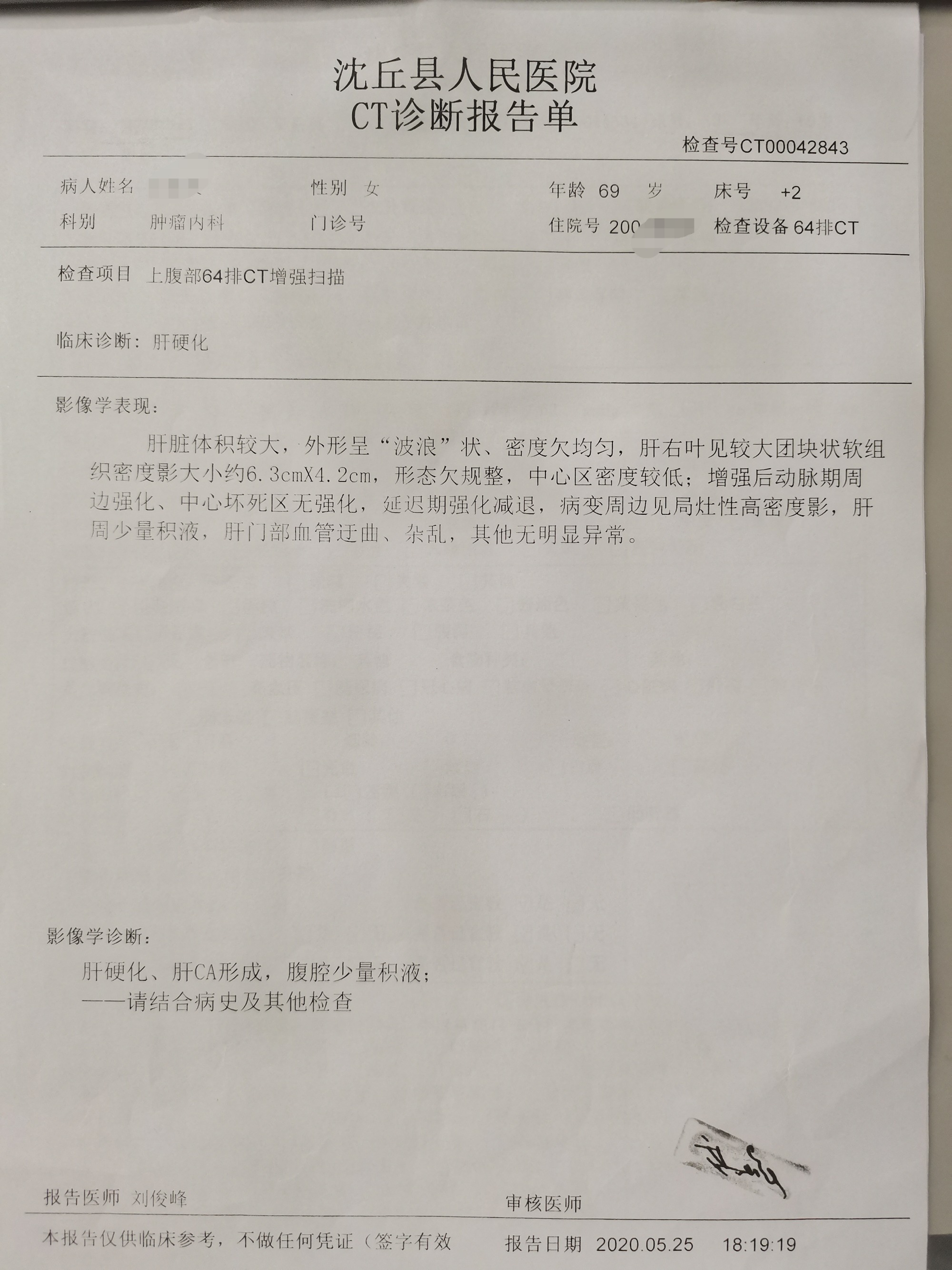 贝伐珠单抗最新价格_贝伐珠单抗注射液_贝伐珠单抗结肠腺癌