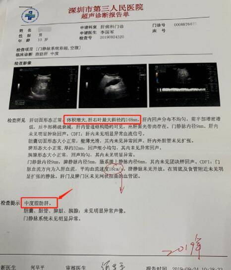 贝伐珠单抗结肠腺癌_贝伐珠单抗最新价格_贝伐珠单抗注射液