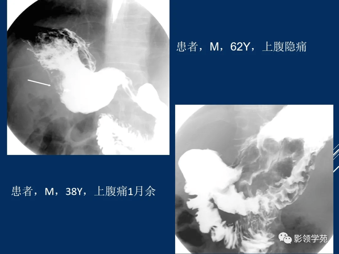 患者女,65岁,因拟行转移化疗(组图)