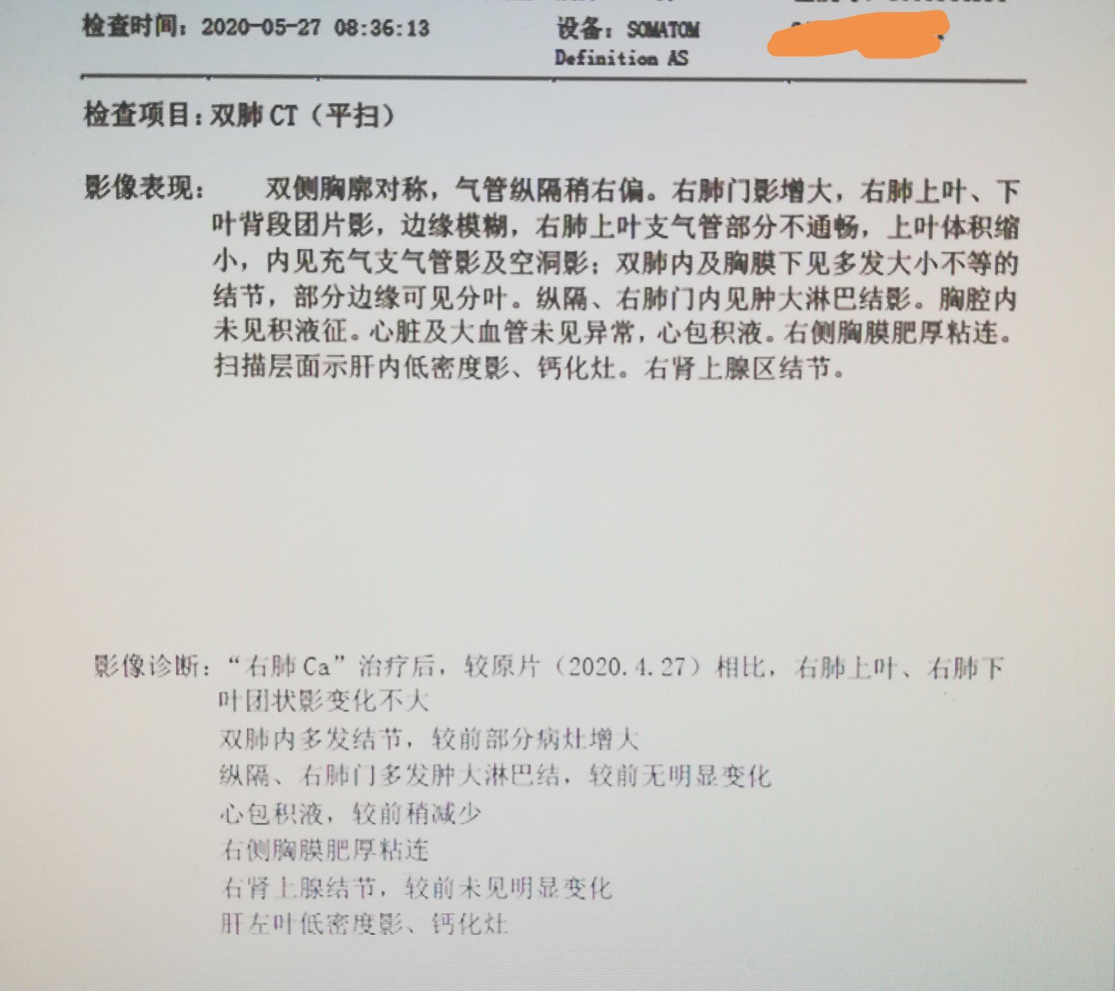 奥希替尼二代靶向药_靶向药安罗替尼_奥希替尼9291药品