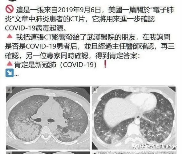 奥希替尼9291_停用奥希替尼_甲磺酸奥希替尼片