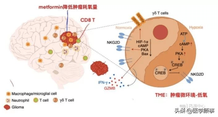 尼塔库碳吉他和男高音_吉非替尼神经毒性_tnt 神经毒性