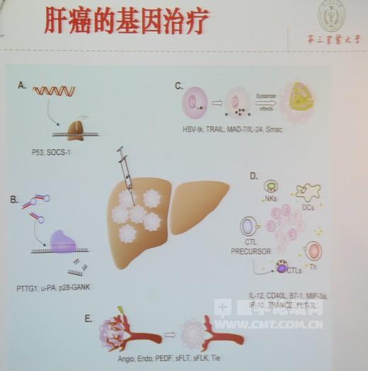 肝癌与贝伐珠单抗_贝伐珠单抗注射液_贝伐珠单抗是化疗药吗