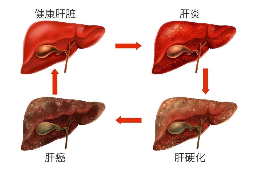 
吉非替尼片(易瑞沙)会不定期地根据市场发展需求而更换包装