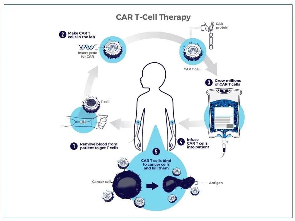 嵌合抗原受体T细胞（CAR-T）疗法的成功应用