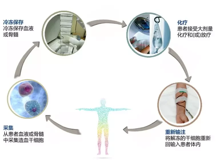 胃肠间质瘤治疗指南ppt_索拉非尼能治疗胃肠间质瘤不_间充质干细胞治疗排异