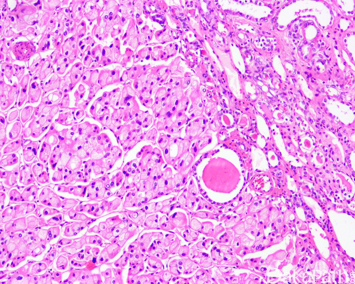 腺垂体嫌色细胞图片